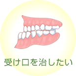 受け口を治したい