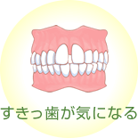 すきっ歯が気になる