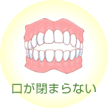 口が閉まらない